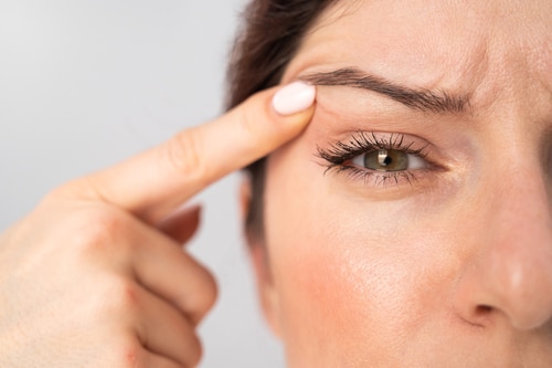 women holding up her drooping eyelid