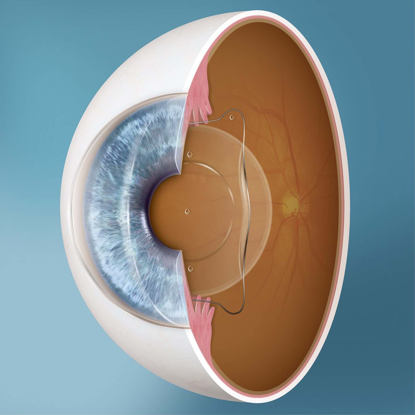 a graphoc that represents the inside of the eyeball